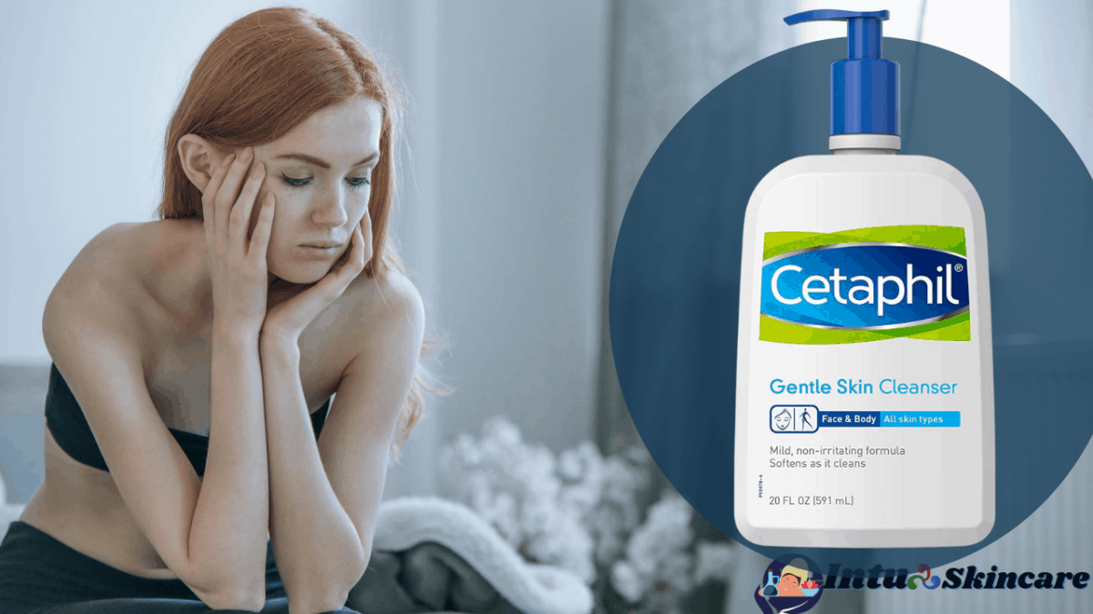 Is the Cetaphil Gentle Cleanser good for acne